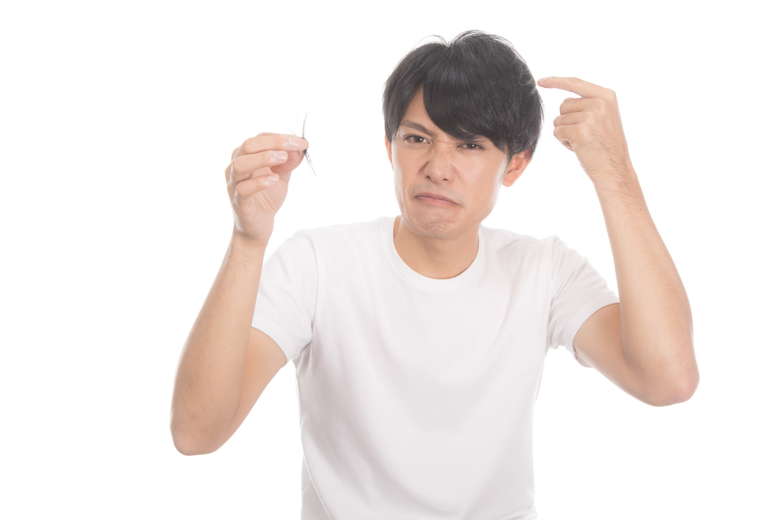 テストステロンの過剰分泌により頭髪が薄くなりヒゲが濃くなった男性